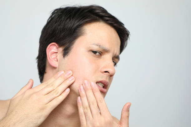 hombre joven comprobando su piel facial. concepto de cuidado de la piel de los hombres. - human skin sparse washing face human face fotografías e imágenes de stock