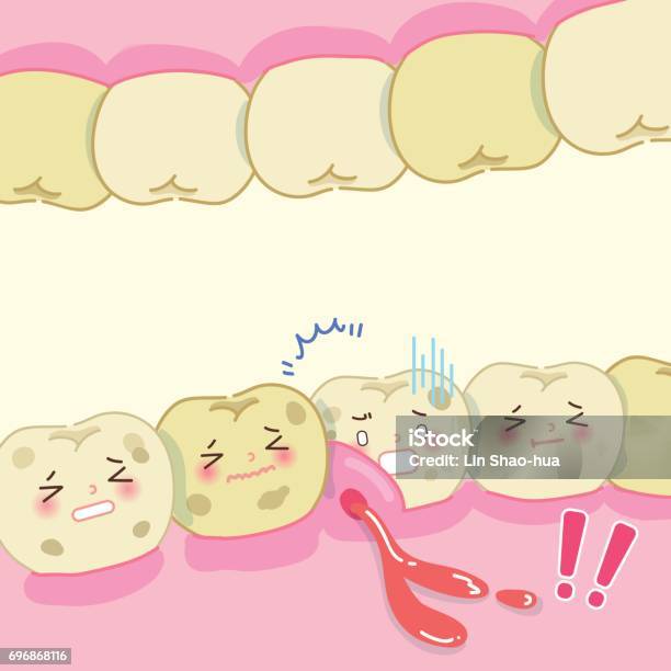 Tooth Defects Animation Cartoon Tooth Decay Problem Stock Illustration - Download Image Now ...