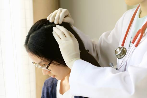 Female doctor looking at patient's hair and scalp, Dermatologist exam scalp disorder. Female doctor looking at patient's hair and scalp, Dermatologist exam scalp disorder. hairless animal photos stock pictures, royalty-free photos & images