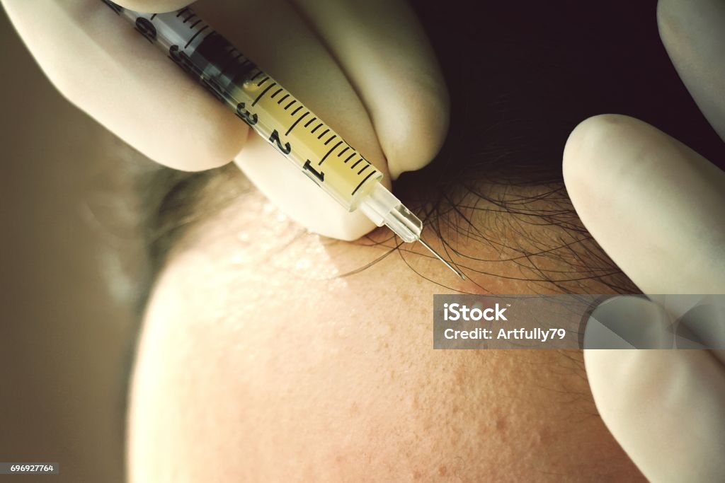 Acne Treatment Dermatologist Doctor Injecting Medicine To Recover Pimples  Skin Problem Stock Photo - Download Image Now - iStock