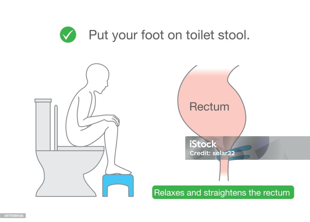 Straightens the rectum while sitting on toilet with small benches. Put your foot on small benches while sitting on toilet for relax muscle and straightens the rectum. Illustration about Correct posture for healthy. Feces stock vector