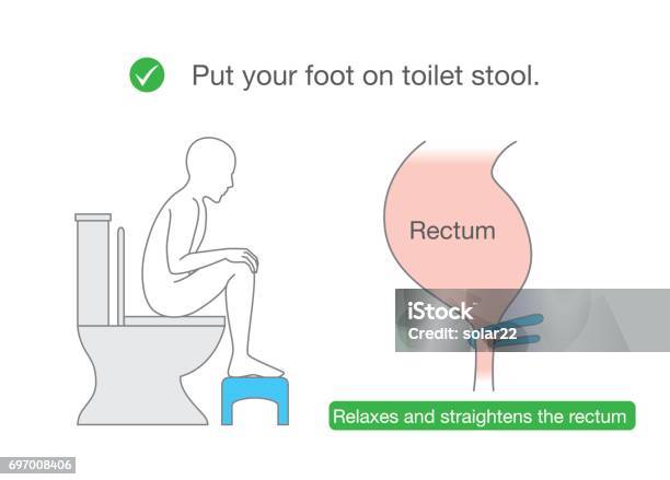 Straightens The Rectum While Sitting On Toilet With Small Benches Stock Illustration - Download Image Now