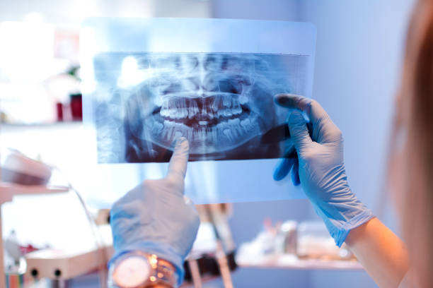 primo piano della dottoressa che punta l'immagine a raggi x dei denti allo studio dentistico. - radiografia foto e immagini stock