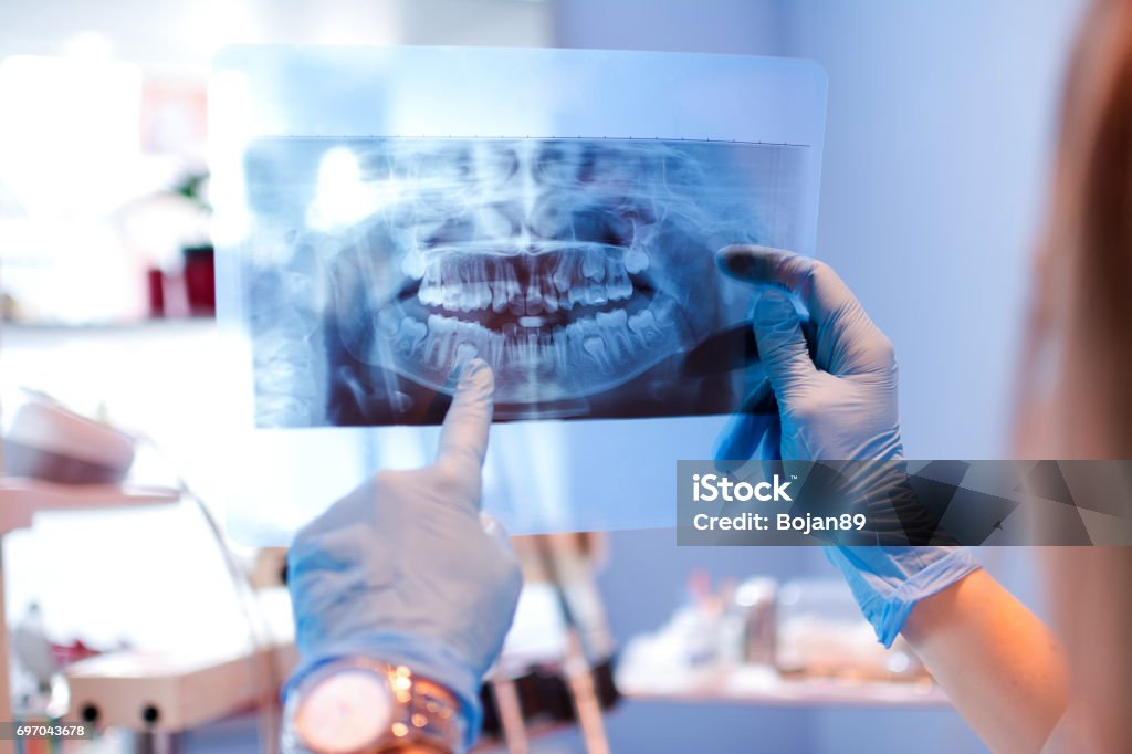 Close-up of female doctor pointing at teeth x-ray image at dental office. Dental Health Stock Photo