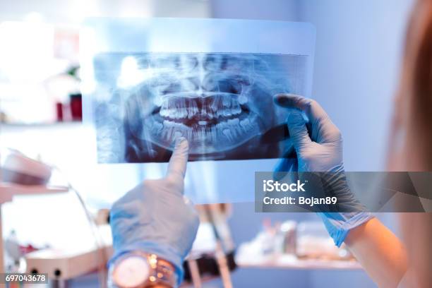 Closeup Of Female Doctor Pointing At Teeth Xray Image At Dental Office Stock Photo - Download Image Now