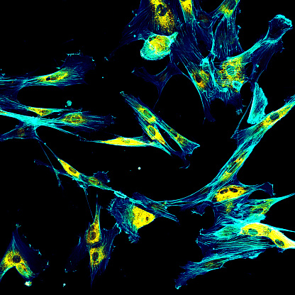 Proyección de imagen confocal de la inmunofluorescencia de los fibroblastos con endoplasmic reticulum en amarillo y citoesqueleto en cyan photo