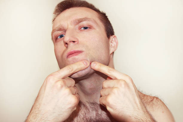 istock A man presses a pimple, bad skin on a white background. 697253176