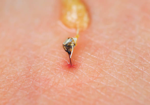 piqûre d’abeille pointus avec un sac de poison a brisé la peau et l’a laissé - piqure de guepe photos et images de collection