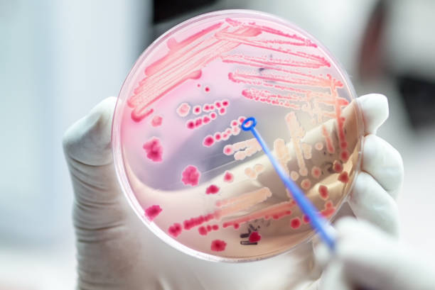 le colonie di escherichai coli di batteri rosa fermentano la coltura del lattosio sull'agar macconkey nel reparto di microbiologia dell'ospedale. - petri dish bacterium science laboratory foto e immagini stock