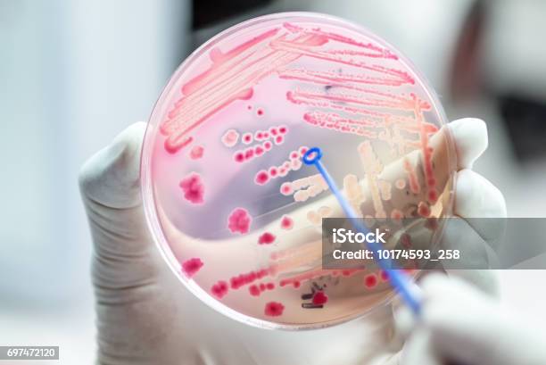 Escherichai 大腸菌コロニー ピンク細菌の発酵マッコンキー寒天培地微生物学教室病院内で乳糖文化です - 敗血症のストックフォトや画像を多数ご用意