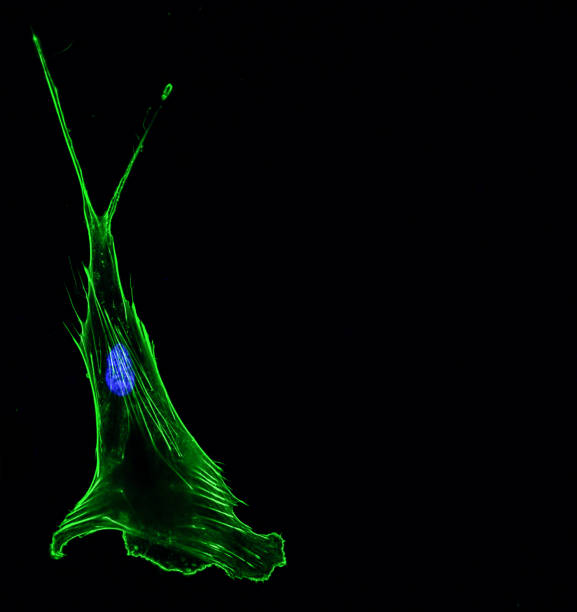 kuvapankkikuvat ja rojaltivapaat kuvat aiheesta immunofluoresenssi confocal kuvantaminen yhdestä invasiivisesta keuhkosyöpäsolusta, jossa on sytoskeleton vihreällä ja ydin sinisellä - cytoskeleton