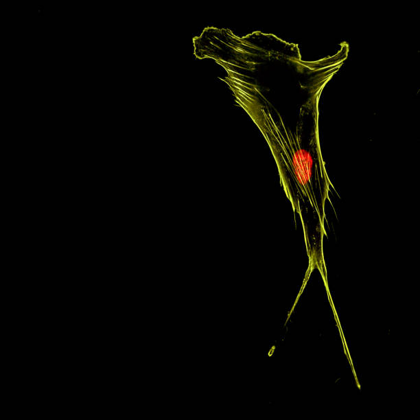 kuvapankkikuvat ja rojaltivapaat kuvat aiheesta immunofluoresenssi confocal kuvantaminen yhdestä invasiivisesta mesenkymaalisesta rintasyöpäsolusta, jossa on sytoskeleton keltaisena ja ydin punaisena - cytoskeleton