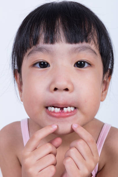istock Asian Chinese little girl showing her missing tooth 697646808