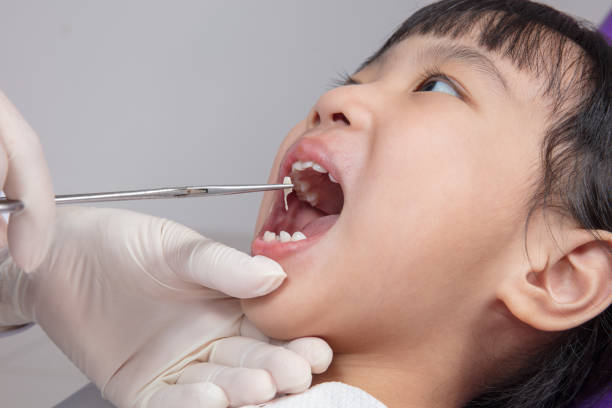 istock Asian Chinese little girl lying down for tooth extraction 697646872