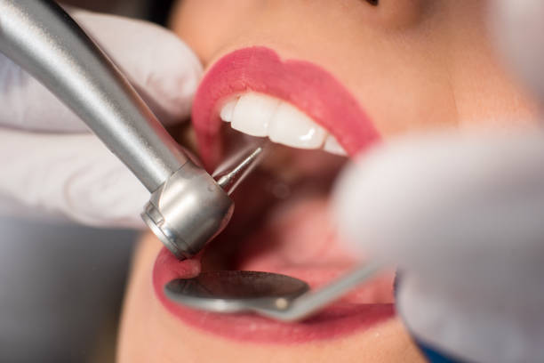 istock Dentist teating a patient's teeth with dental tools - mirror and drill with water spray in dental clinic. Dentistry. Close-up, super macro shot 698031228