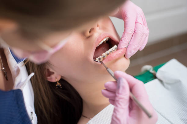 여성 치과 치과 사무실에서 금속 괄호와 환자 치아를 검사. 약, 치과 및 건강 관리 개념입니다. 치과 장비 - dentist office work tool hygiene mirror 뉴스 사진 이미지