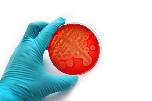 バクテリアの文化 - blood agar ストックフォトと画像