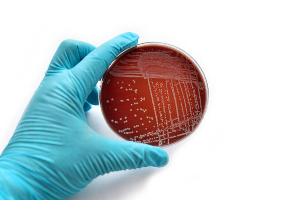 バクテリアの文化 - agar jelly medical sample bacterium microbiology ストックフォトと画像