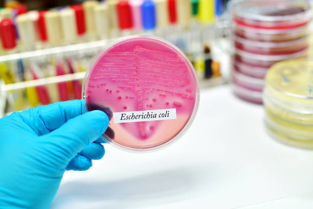 escherichia coli - petri dish bacterium microbiology streptococcus - fotografias e filmes do acervo