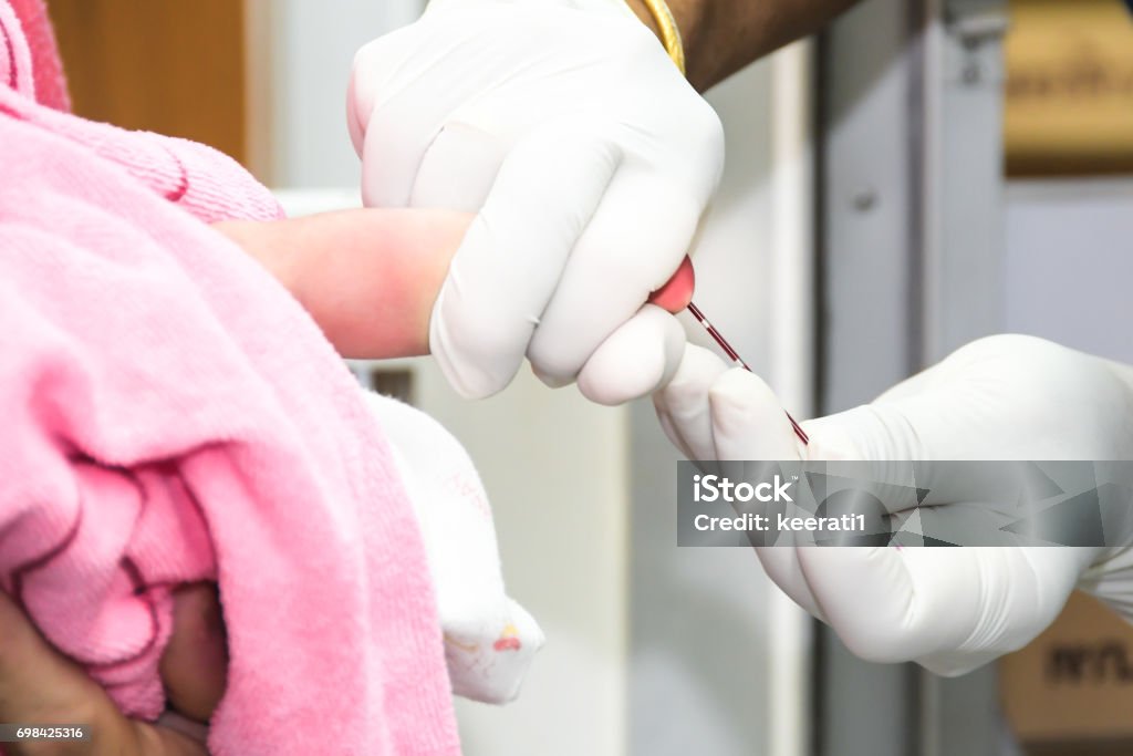 Pricking baby foot blood test Adhesive Tape Stock Photo