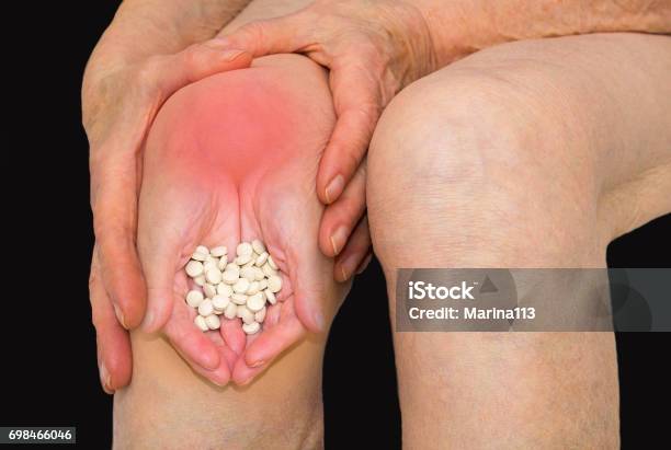 Senior Woman Holding The Knee With Pain Stock Photo - Download Image Now - Image Montage, Composite Image, Women