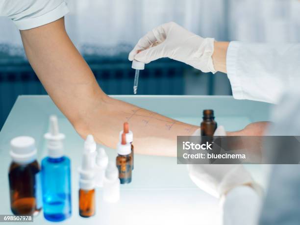 Skin Prick Allergy Test Stock Photo - Download Image Now - Allergy, Allergy Test, Scientific Experiment