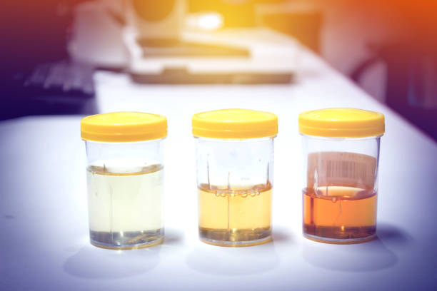 Urine Urine sample urine stock pictures, royalty-free photos & images