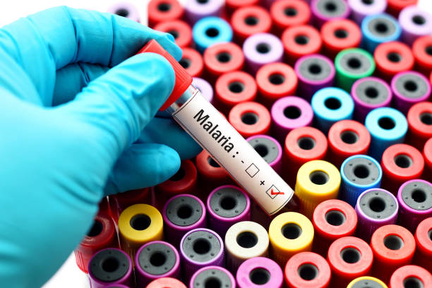 Malaria positive Blood sample positive with malaria parasite malaria blood sample stock pictures, royalty-free photos & images