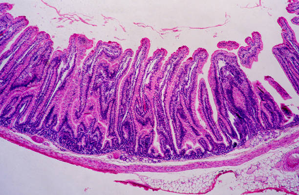 장 - submucosa 뉴스 사진 이미지