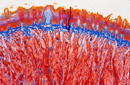 Tongue cross section with taste buds or gustatory cells. Optical microscope, magnification X40.