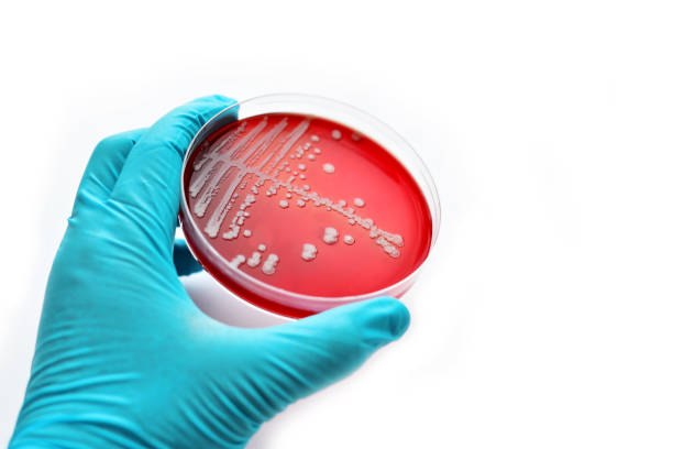 バクテリア コロニー - blood agar ストックフォトと画像