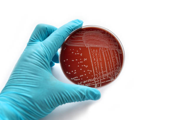 バクテリア コロニー - agar jelly medical sample bacterium microbiology ストックフォトと画像