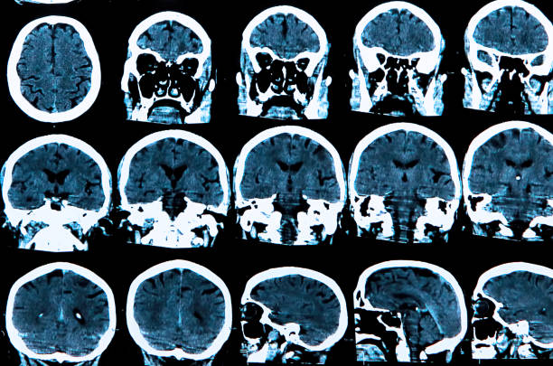 cerebro humano - phase image mri scan science nobody fotografías e imágenes de stock