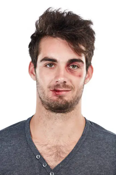 Studio portrait of a young man with scratches on his face against a white background
