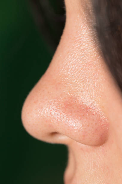 istock Women's nose, close-up 701135502