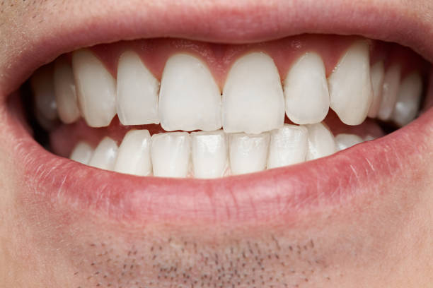 istock Macro of healthy man teeth 701265814