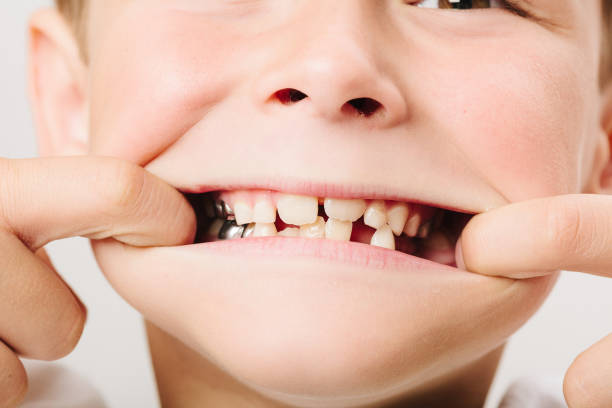 istock Close-Up Of Boy Showing Teeth 769819973