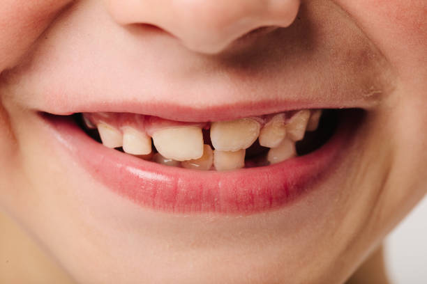 istock Close-Up Of Boy Showing Teeth 769830587