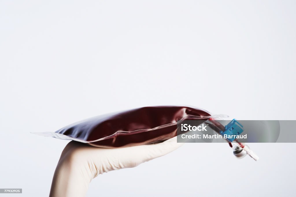 Una mano guantata con una sacca EV di sangue intero - Foto stock royalty-free di Fleboclisi