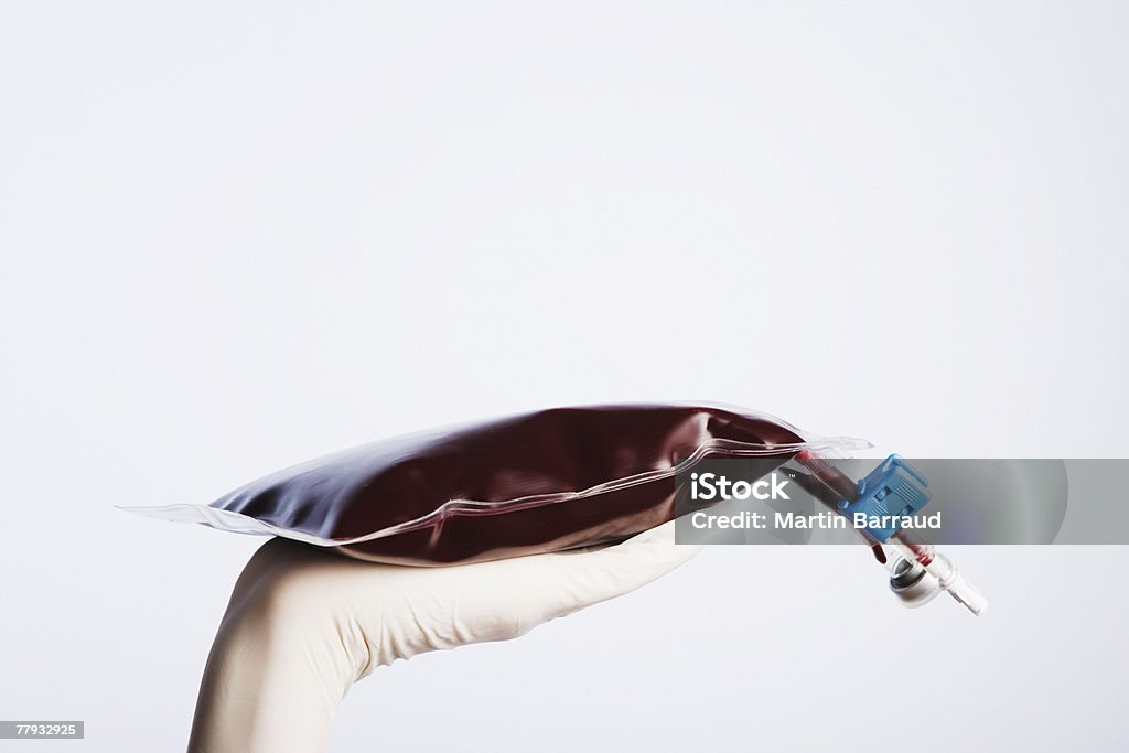 Urządzenie może być obsługiwane nawet w rękawiczkach, trzymając z worka infuzyjnego pełnej krwi - Zbiór zdjęć royalty-free (Infuzja dożylna)