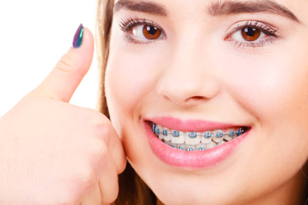 istock Woman showing her teeth with braces 800009188
