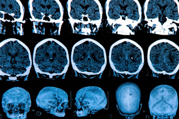 cerebro humano - phase image mri scan science nobody fotografías e imágenes de stock