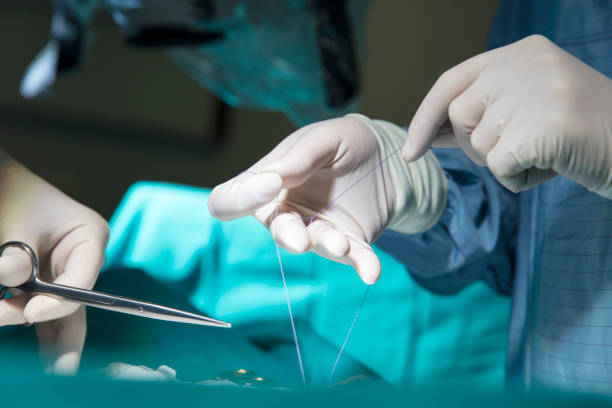 Doctor make a Surgical stitch stock photo