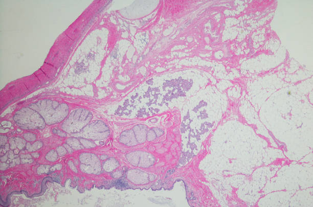 teratoma ovárico quístico maduro - ovary human cell cell high scale magnification fotografías e imágenes de stock