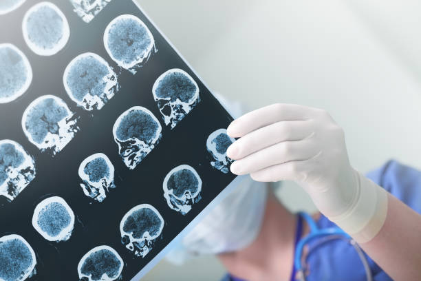 医療専門家は、患者の脳波状態を検討しました。 - brain mri scan alzheimers disease medical scan ストックフォ��トと画像
