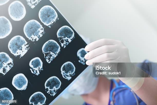 Medical Experts Studied The Eeg Condition Of The Patient Stock Photo - Download Image Now