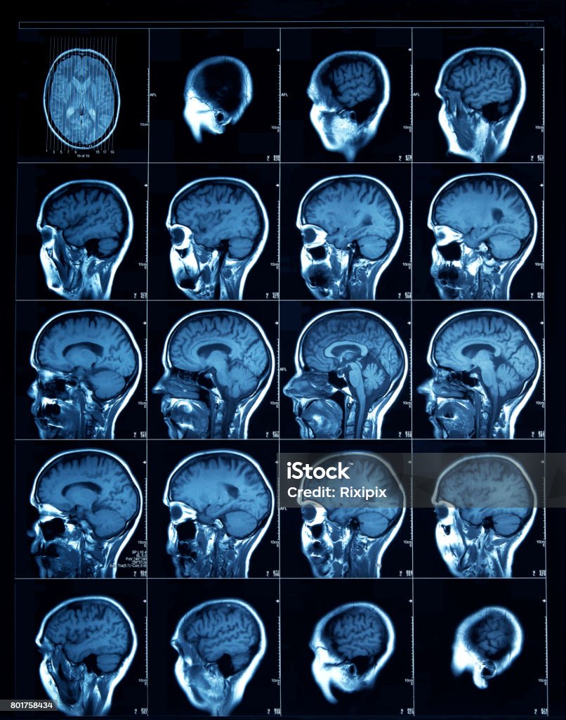 CT scan d’un humain adulte - Photo de Imagerie par rayons x libre de droits