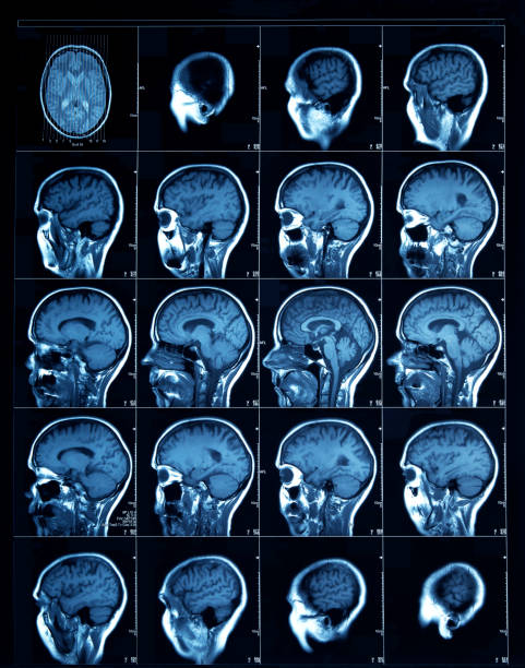 datortomografi av en vuxen människa - brain scan' bildbanksfoton och bilder