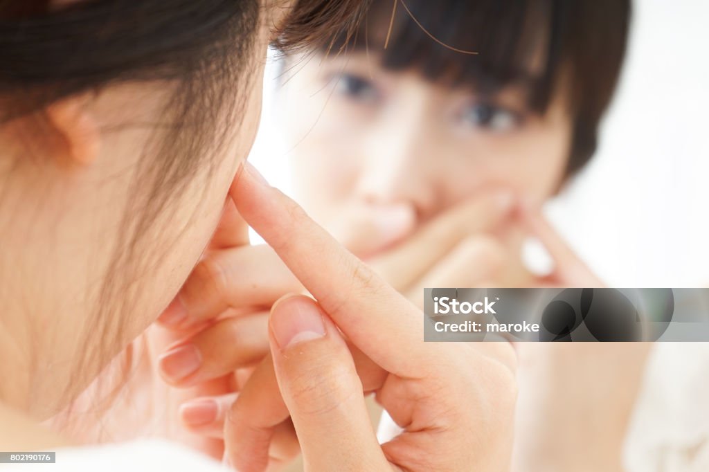 Young woman caring for skin problems Acne Stock Photo