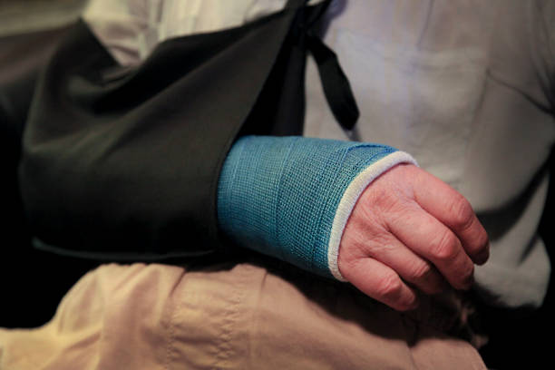 Man with Broken Arm Old man with a broken arm cast wearing an arm sling. man with arm sling stock pictures, royalty-free photos & images